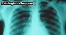 Tórax Escola Guaicuru
